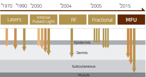 haifu gold premium trend