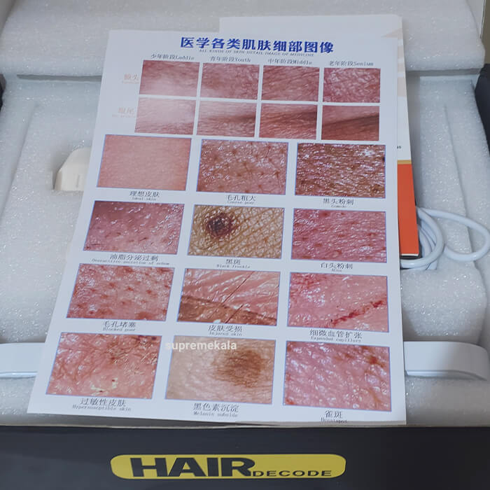lizze 11 inch skin hair analyzer 8